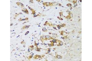 Immunohistochemistry (Paraffin-embedded Sections) (IHC (p)) image for anti-ER Lipid Raft Associated 1 (ERLIN1) antibody (ABIN7258170)
