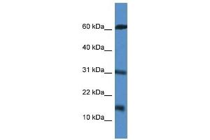 Western Blot showing CARD17 antibody used at a concentration of 1 ug/ml against Jurkat Cell Lysate (CARD17 抗体  (Middle Region))