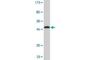 Western Blot detection against Immunogen (49. (KCNIP1 抗体  (AA 1-216))