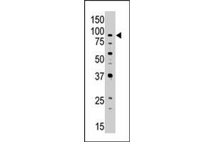 The ABCB7 polyclonal antibody  is used in Western blot to detect ABCB7 in Jurkat cell lysate. (ABCB7 抗体  (C-Term))