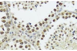 Immunohistochemistry of paraffin-embedded Mouse testis using Phospho-Histone H3(T11) Polyclonal Antibody at dilution of 1:100 (40x lens). (Histone 3 抗体  (pThr11))
