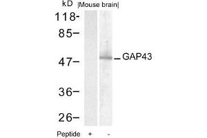 Western blot analysis of extracts from mouse brain tissue using GAP43(Ab-41) Antibody and the same antibody preincubated with blocking peptide. (GAP43 抗体)