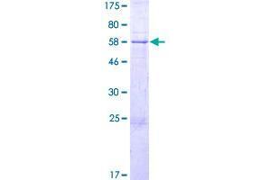Image no. 1 for Ankyrin Repeat Domain 9 (ANKRD9) (AA 1-317) protein (GST tag) (ABIN1345129) (ANKRD9 Protein (AA 1-317) (GST tag))