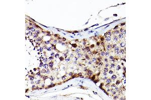 Immunohistochemistry of paraffin-embedded Human testis using S antibody (ABIN7270138) at dilution of 1:200 (40x lens). (SALL4 抗体  (AA 853-1053))