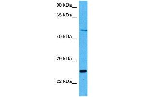 Host:  Mouse  Target Name:  PAX6  Sample Tissue:  Mouse Kidney  Antibody Dilution:  1ug/ml (PAX6 抗体  (N-Term))