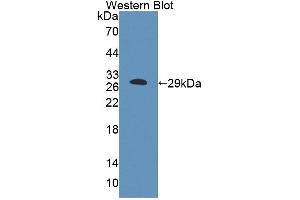 Western Blotting (WB) image for anti-ATP-Binding Cassette, Sub-Family F (GCN20), Member 1 (ABCF1) (AA 617-837) antibody (ABIN5013199)