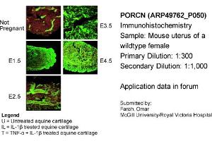 Immunohistochemistry (IHC) image for anti-Porcupine Homolog (PORCN) (N-Term) antibody (ABIN2783888) (PORCN 抗体  (N-Term))