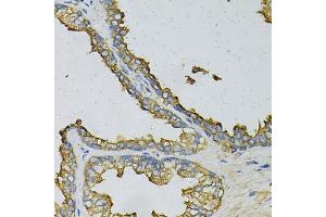 Immunohistochemistry of paraffin-embedded human prostate using RPLP0 Antibody (ABIN6290910) at dilution of 1:100 (40x lens). (RPLP0 抗体)