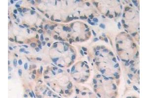 Detection of PARP in Mouse Intestine Tissue using Polyclonal Antibody to Poly ADP Ribose Polymerase (PARP) (PARP1 抗体  (AA 661-881))