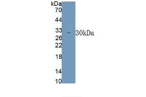 Detection of Recombinant TNFSF12, Rat using Polyclonal Antibody to Tumor Necrosis Factor Ligand Superfamily, Member 12 (TNFSF12) (TWEAK 抗体)