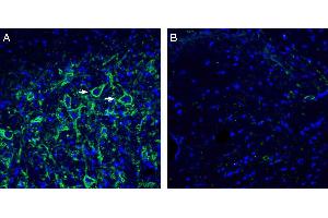 Expression of Neuroligin-3 in rat deep cerebellar nuclei. (Neuroligin 3 抗体  (Extracellular, N-Term))