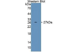 Western blot analysis of the recombinant protein. (SRSF1 抗体  (AA 16-224))