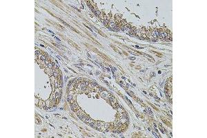 Immunohistochemistry of paraffin-embedded human prostate using PDCD6IP antibody.