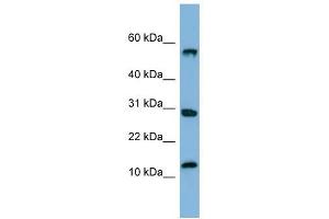SRP19 antibody used at 1 ug/ml to detect target protein. (SRP19 抗体  (Middle Region))