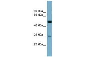 Image no. 1 for anti-RAB27A, Member RAS Oncogene Family (RAB27A) (C-Term) antibody (ABIN6741985) (RAB27A 抗体  (C-Term))