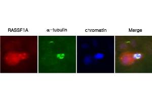 Immunofluorescence (IF) image for anti-Ras Association (RalGDS/AF-6) Domain Family Member 1 (RASSF1) (AA 1-340), (Isoform A), (N-Term) antibody (ABIN121164)