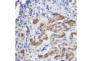 Immunohistochemistry (IHC) image for anti-Staphylococcal Nuclease Domain Containing Protein 1 (SND1) (AA 26-285) antibody (ABIN6148197)