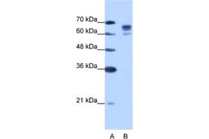 Western Blotting (WB) image for anti-DEAD (Asp-Glu-Ala-Asp) Box Polypeptide 17 (DDX17) antibody (ABIN2462307) (DDX17 抗体)