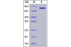SDS-PAGE (SDS) image for Receptor Tyrosine-Protein Kinase ErbB-3 (ERBB3) (AA 20-643) (Active) protein (His tag,AVI tag,Biotin) (ABIN6933652)