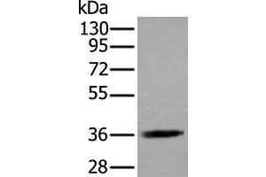Western blot analysis of Jurkat cell lysate using ACAT2 Polyclonal Antibody at dilution of 1:550 (ACAT2 抗体)