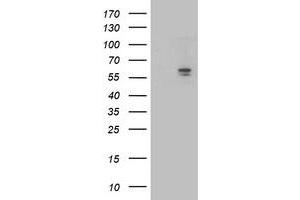 Western Blotting (WB) image for anti-Aldehyde Dehydrogenase 3 Family, Member A2 (ALDH3A2) antibody (ABIN1496594) (ALDH3A2 抗体)