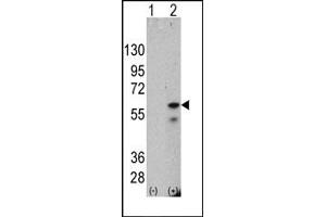 Western Blotting (WB) image for anti-PTEN Induced Putative Kinase 1 (PINK1) antibody (ABIN356392) (PINK1 抗体)