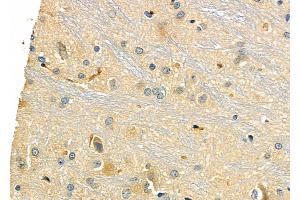 ABIN6258972 and ABIN6275963 at 1/100 staining Rat brain tissue by IHC-P. (GPR173 抗体  (Internal Region))