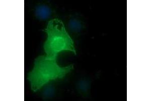 Image no. 1 for anti-Epithelial Cell Adhesion Molecule (EPCAM) antibody (ABIN1498119)