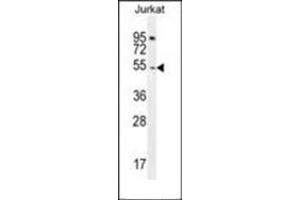 Western blot analysis of DARS1 Antibody (N-term) in Jurkat cell line lysates (35ug/lane).