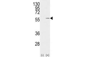Western blot analysis of Vimentin antibody and 293 cell lysate (2 ug/lane) either nontransfected (Lane 1) or transiently transfected with the VIM gene (2). (Vimentin 抗体  (AA 63-90))