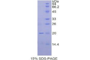 SDS-PAGE analysis of Human IHH Protein.