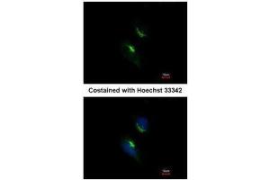 ICC/IF Image Immunofluorescence analysis of methanol-fixed HeLa, using PRPS1, antibody at 1:200 dilution. (PRPS1 抗体)