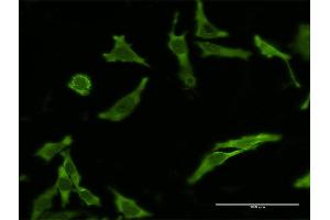 Immunofluorescence (IF) image for anti-CASP8 and FADD-Like Apoptosis Regulator (CFLAR) (AA 178-277) antibody (ABIN522287)