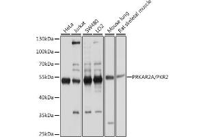 Western Blotting (WB) image for anti-Protein Kinase, CAMP-Dependent, Regulatory, Type II, alpha (PRKAR2A) (AA 1-404) antibody (ABIN1513416)