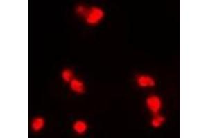 Immunofluorescent analysis of INI1 staining in MCF7 cells.
