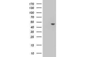 Western Blotting (WB) image for anti-Adipocyte Plasma Membrane Associated Protein (APMAP) antibody (ABIN1496665)