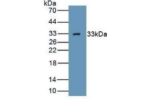 Detection of Recombinant HABP1, Human using Polyclonal Antibody to Complement component 1 Q subcomponent-binding protein, mitochondrial (C1QBP)