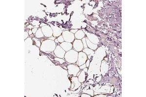 Immunohistochemical staining (Formalin-fixed paraffin-embedded sections) of human soft tissue with ACACB polyclonal antibody  shows strong cytoplasmic and membranous positivity in adipocytes.