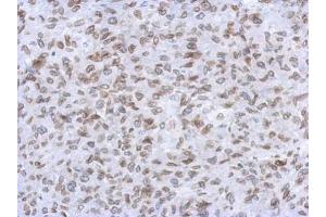 IHC-P Image Immunohistochemical analysis of paraffin-embedded RT2 xenograft, using Lamin A + C, antibody at 1:500 dilution. (Lamin A/C 抗体)