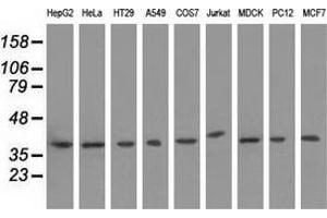 Western blot analysis of extracts (35 µg) from 9 different cell lines by using anti-HIBCH monoclonal antibody. (HIBCH 抗体)