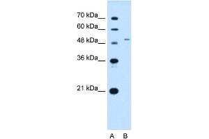 Western Blotting (WB) image for anti-Solute Carrier Family 29 (Nucleoside Transporters), Member 2 (SLC29A2) (N-Term) antibody (ABIN2781571)
