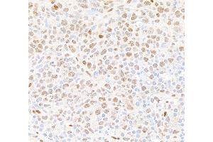 Immunohistochemistry (IHC) image for anti-Tumor Protein P53 Binding Protein 1 (TP53BP1) (AA 350-400) antibody (ABIN7453568) (TP53BP1 抗体  (AA 350-400))