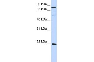 WB Suggested Anti-ARL11 Antibody Titration: 0. (ARL11 抗体  (Middle Region))