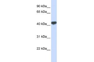 WB Suggested Anti-ZRANB2 Antibody Titration:  0. (ZNF265 抗体  (N-Term))