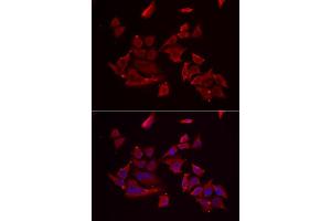 Immunofluorescence analysis of MCF-7 cells using RARRES2 antibody (ABIN5974187). (Chemerin 抗体)