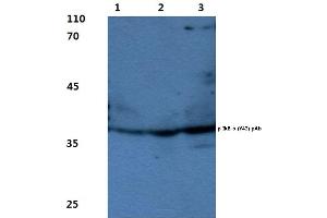Western blot(WB) analysis of p-IkB-α antibody (NFKBIA 抗体  (pTyr42))