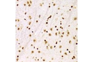 Immunohistochemistry (IHC) image for anti-Histone 3 (H3) (C-Term) antibody (ABIN3023243)