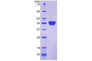 SDS-PAGE analysis of Mouse SSA1 Protein. (TRIM21 蛋白)
