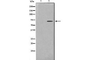 Western blot analysis on COLO205 cell lysate using TF2H2 Antibody,The lane on the left is treated with the antigen-specific peptide. (GTF2H2 抗体  (N-Term))