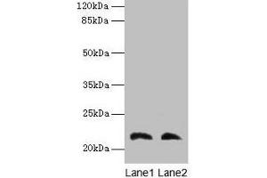 Western blot All lanes: LGALS9C antibody at 4 μg/mL Lane 1: Mouse stomach tissue Lane 2: Mouse liver tissue Secondary Goat polyclonal to rabbit IgG at 1/10000 dilution Predicted band size: 40 kDa Observed band size: 22 kDa (LGALS9C 抗体  (AA 1-356))